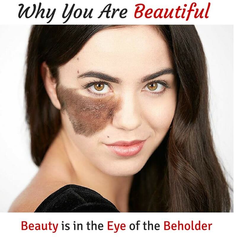 Beauty in Disability 2 comp